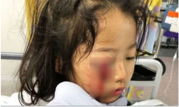 Bé trai 4 tuổi bị thương tổn nặng ở tai vì đồ vật này trong siêu thị, bất kỳ cửa hàng quần áo nào cũng có - Ảnh 2